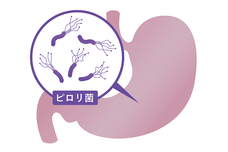 ピロリ菌とは？